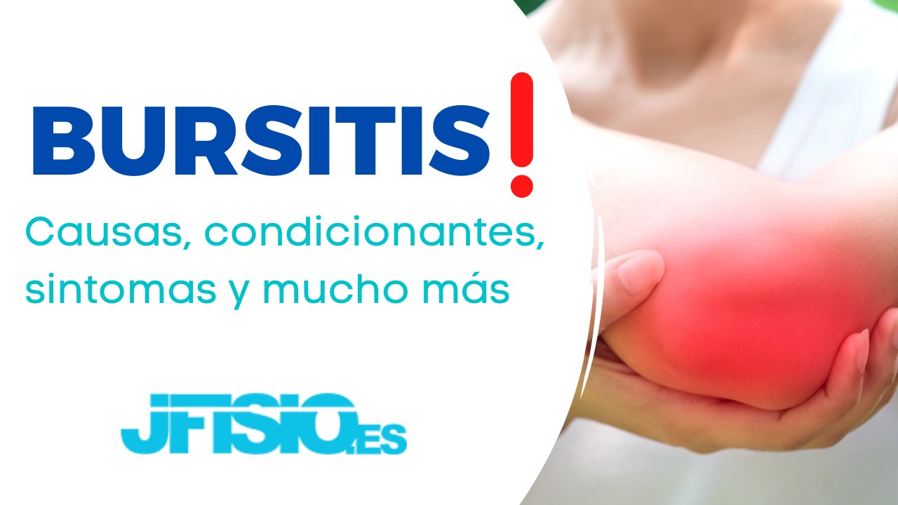 fisioterapia bursitis jfisio