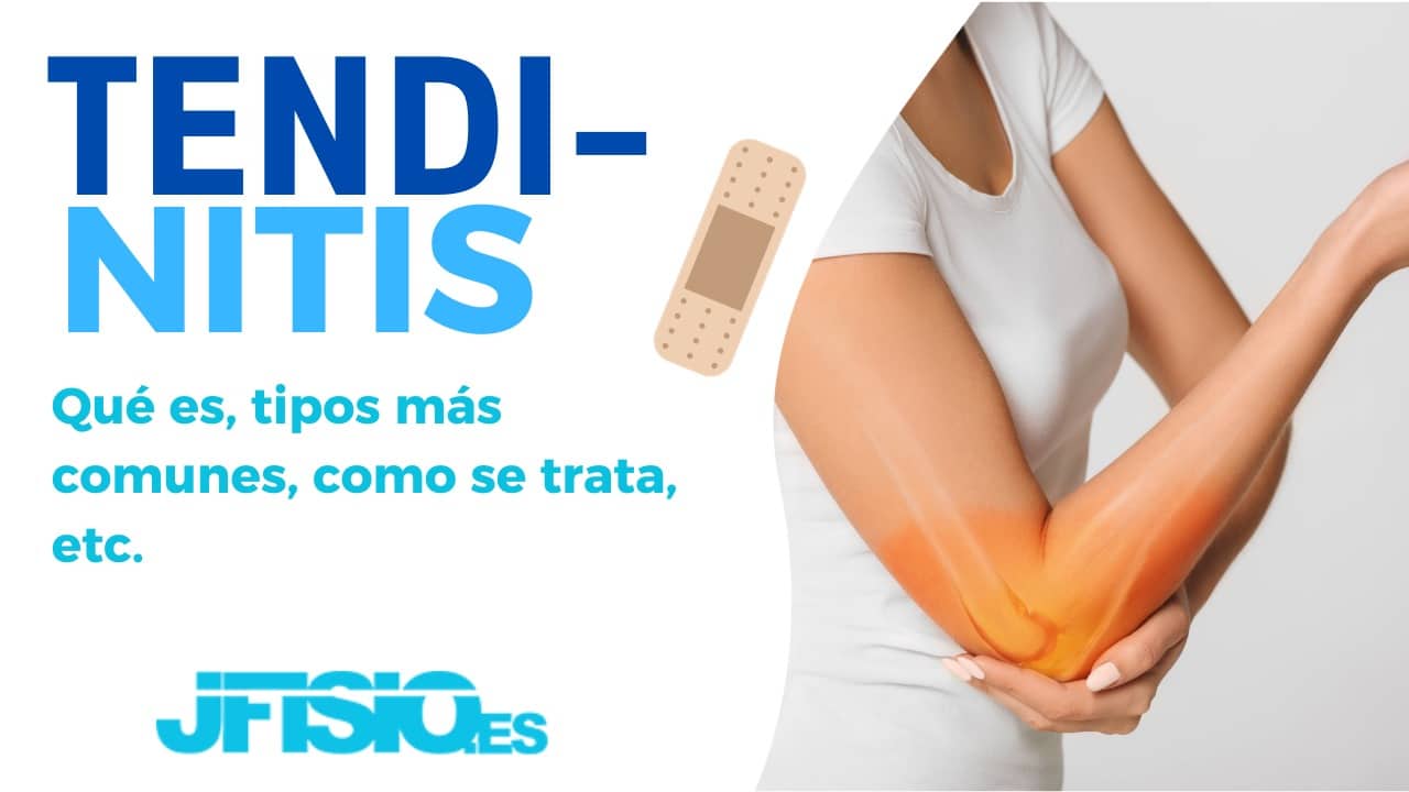 fisioterapeuta tendinitis jfisio.es